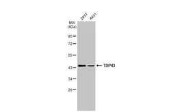 Anti-TDP43 antibody [GT6310] used in Western Blot (WB). GTX633973