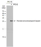 Anti-Porcine circovirus type 2 / PCV2 Capsid antibody [GT972] used in Western Blot (WB). GTX634211