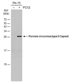 Anti-Porcine circovirus type 2 / PCV2 Capsid antibody [GT972] used in Western Blot (WB). GTX634211