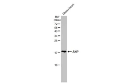 Anti-ANP antibody [GT1068] used in Western Blot (WB). GTX634219