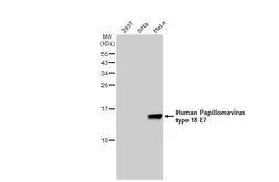 Anti-Human Papillomavirus type 18 E7 antibody [GT881] used in Western Blot (WB). GTX634337