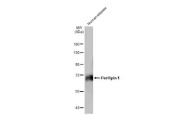 Anti-Perilipin 1 antibody [GT2781] used in Western Blot (WB). GTX634406