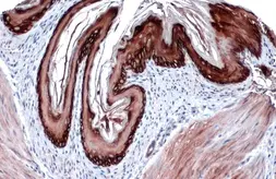 Anti-Cytokeratin 14 antibody [GT985] used in IHC (Paraffin sections) (IHC-P). GTX634409