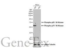 Anti-p70 S6K (phospho Thr421/Ser424) antibody [HL129] used in Western Blot (WB). GTX635621