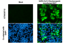 Anti-SARS-CoV-2 (COVID-19) Nucleocapsid antibody [HL455-MS] used in Immunocytochemistry/ Immunofluorescence (ICC/IF). GTX635712