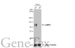Anti-LAMP2 antibody [GT856] used in Western Blot (WB). GTX635790