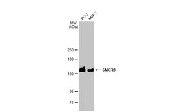 Anti-SMCR8 antibody [HL1007] used in Western Blot (WB). GTX635798