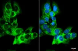 Anti-Anterior Gradient 2 antibody [HL1024] used in Immunocytochemistry/ Immunofluorescence (ICC/IF). GTX635838