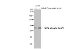 Anti-GRK2 (phospho Ser670) antibody [HL1035] used in Western Blot (WB). GTX635875