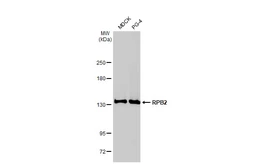 Anti-RPB2 antibody [HL1042] used in Western Blot (WB). GTX635976