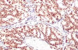 Anti-Androgen Receptor antibody [HL1049] used in IHC (Paraffin sections) (IHC-P). GTX636021