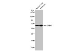 Anti-GAD67 antibody [HL1096] used in Western Blot (WB). GTX636280