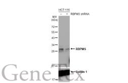 Anti-RBPMS antibody [HL1105] used in Western Blot (WB). GTX636320