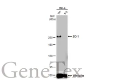 Anti-ZO-1 antibody [HL1133] used in Western Blot (WB). GTX636399