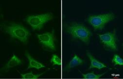 Anti-gamma Tubulin antibody [HL1175] used in Immunocytochemistry/ Immunofluorescence (ICC/IF). GTX636480