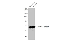 Anti-GAD65 + GAD67 antibody [HL1181] used in Western Blot (WB). GTX636487