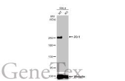 Anti-ZO-1 antibody [HL1185] used in Western Blot (WB). GTX636491