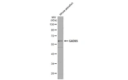 Anti-GAD65 antibody [HL1187] used in Western Blot (WB). GTX636493
