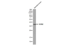 Anti-SOX2 antibody [HL1192] used in Western Blot (WB). GTX636504