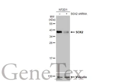 Anti-SOX2 antibody [HL1193] used in Western Blot (WB). GTX636505