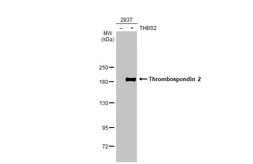 Anti-Thrombospondin 2 antibody [HL1194] used in Western Blot (WB). GTX636506