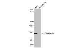 Anti-E-Cadherin antibody [HL1228] used in Western Blot (WB). GTX636576