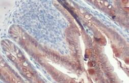 Anti-E-Cadherin antibody [HL1228] used in IHC (Paraffin sections) (IHC-P). GTX636576