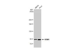 Anti-RRM1 antibody [HL1230] used in Western Blot (WB). GTX636578