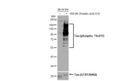 Anti-Tau (phospho Thr217) antibody [HL1276] used in Western Blot (WB). GTX636678