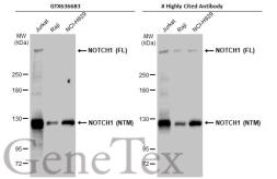 Anti-NOTCH1 antibody [HL1281] used in Western Blot (WB). GTX636683