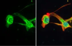 Anti-MFF antibody [HL1313] used in Immunocytochemistry/ Immunofluorescence (ICC/IF). GTX636731