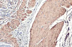 Anti-alpha Smooth Muscle Actin antibody [HL1419] used in IHC (Paraffin sections) (IHC-P). GTX636885