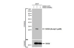 Anti-SOD2 (Acetyl Lys68) antibody [HL1460] used in Western Blot (WB). GTX636934