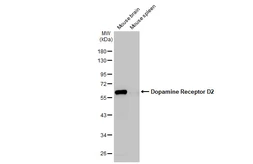 Anti-Dopamine Receptor D2 antibody [HL1478] used in Western Blot (WB). GTX636952