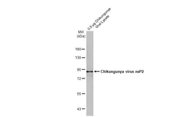 Anti-Chikungunya virus nsP2 antibody [HL1488] used in Western Blot (WB). GTX636962
