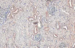 Anti-RAB5A antibody [HL1497] used in IHC (Paraffin sections) (IHC-P). GTX636971