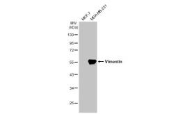 Anti-Vimentin antibody [HL1506] used in Western Blot (WB). GTX636980