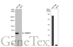 Anti-PARP3 antibody [HL1509] used in Western Blot (WB). GTX636983