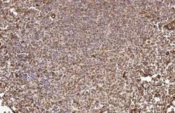Anti-ADAM17 antibody [HL1572] used in IHC (Paraffin sections) (IHC-P). GTX637047
