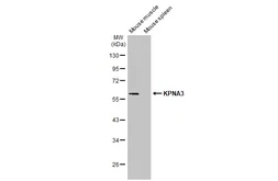 Anti-KPNA3 antibody [HL1573] used in Western Blot (WB). GTX637048