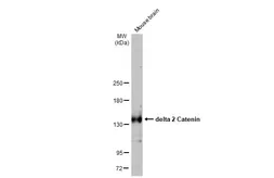 Anti-delta 2 Catenin antibody  [HL1629] used in Western Blot (WB). GTX637122