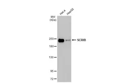 Anti-SCRIB antibody [HL1639] used in Western Blot (WB). GTX637220