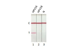 Anti-Human Papillomavirus type 16 E7 antibody [HL1647] used in Lateral Flow (Lateral Flow). GTX637228