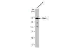 Anti-SNAP91 antibody [HL1657] used in Western Blot (WB). GTX637255
