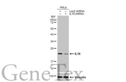 Anti-IL18 antibody [HL1761] used in Western Blot (WB). GTX637411