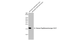 Anti-Human Papillomavirus type 16 E7 antibody [HL1821] used in Western Blot (WB). GTX637546