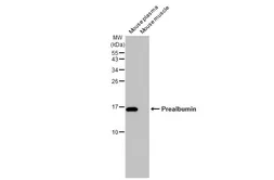Anti-Prealbumin antibody [HL1823] used in Western Blot (WB). GTX637548