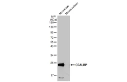 Anti-CRALBP antibody [HL1833] used in Western Blot (WB). GTX637558