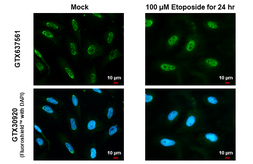 Anti-ATR (phospho Thr1989) antibody [HL1836] used in Immunocytochemistry/ Immunofluorescence (ICC/IF). GTX637561