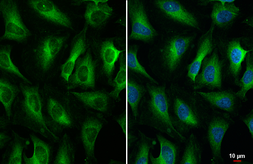 Anti-ZC3HAV1 antibody [HL1884] used in Immunocytochemistry/ Immunofluorescence (ICC/IF). GTX637633